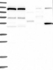 NBP1-81507 - DNAJC6
