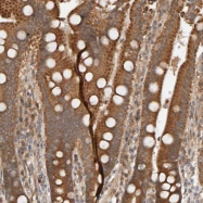 NBP1-86920 - DNAJC7 / TPR2