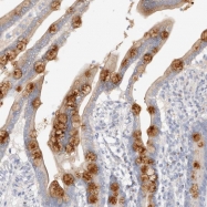 NBP1-84999 - Deoxyribonuclease-1