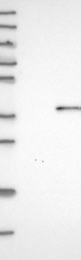 NBP1-84999 - Deoxyribonuclease-1