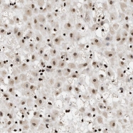 NBP1-85000 - Deoxyribonuclease gamma