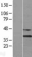 NBL1-09963 - DNASE1L3 Lysate