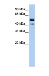 NBP1-62279 - Deoxyribonuclease-2-beta