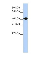 NBP1-69308 - Deoxyribonuclease-2-beta