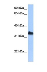 NBP1-57258 - DND1 / RBMS4