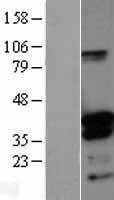 NBL1-09975 - DNTTIP1 Lysate