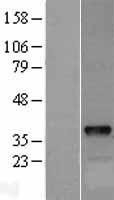 NBL1-09980 - DOK5 Lysate