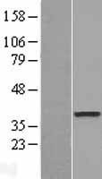 NBL1-09981 - DOK6 Lysate