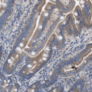 NBP1-81286 - Dolichyldiphosphatase 1