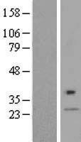 NBL1-09985 - DPAGT1 Lysate