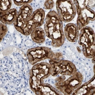 NBP1-86087 - Dipeptidase 1