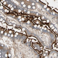 NBP1-86115 - Dipeptidase 1