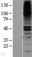 NBL1-09988 - DPEP1 Lysate