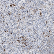 NBP1-84276 - ZCSL2