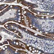 NBP1-87969 - DPH4