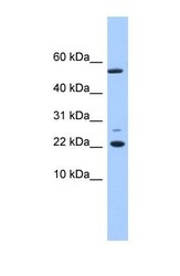 NBP1-56748 - DPH4