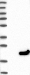 NBP1-87968 - DPH4