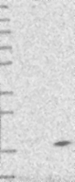 NBP1-81216 - DPM3
