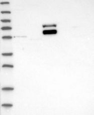 NBP1-84986 - DPP2