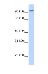 NBP1-59427 - DPP6