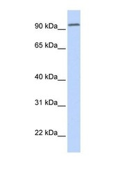 NBP1-59925 - DPP6