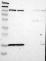NBP1-84993 - DPP8 / DPRP1