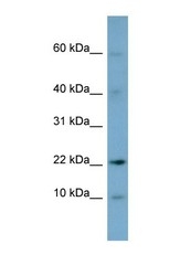 NBP1-52919 - DPPA5 / ESG1