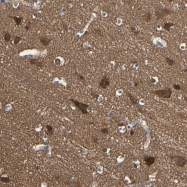 NBP1-84982 - TNFRSF21 / Death receptor 6 (DR6)