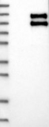 NBP1-84982 - TNFRSF21 / Death receptor 6 (DR6)