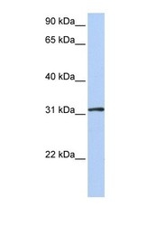 NBP1-55158 - DRG1 / NEDD3