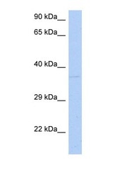 NBP1-55296 - DRG1 / NEDD3