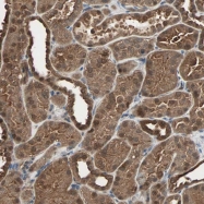 NBP1-89461 - DRG2
