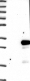 NBP1-88776 - DTD1