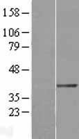 NBL1-10037 - DTX3 Lysate