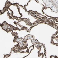 NBP1-88699 - DTX3L / BBAP