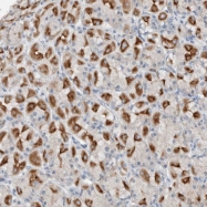 NBP1-81301 - Dual oxidase 1