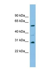 NBP1-57742 - DUS1L