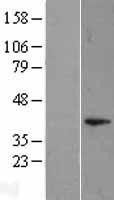 NBL1-10047 - DUSP11 Lysate