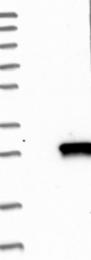 NBP1-81046 - DUSP14 / MKP6