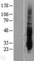 NBL1-10049 - DUSP14 Lysate