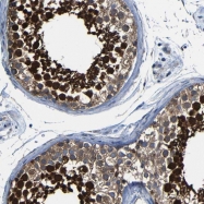 NBP1-86472 - DUPD1 / DUSP27