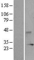 NBL1-10053 - DUSP3 Lysate