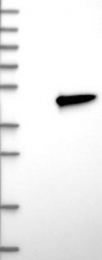 NBP1-82641 - DUSP9 / MKP4