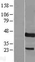 NBL1-10059 - DUSP9 Lysate