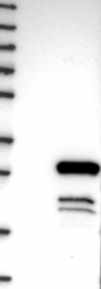 NBP1-88779 - DYDC1