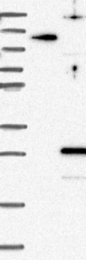 NBP1-88780 - DYDC1