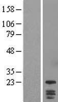 NBL1-10065 - DYDC1 Lysate