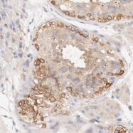 NBP1-84254 - DYNC1H1