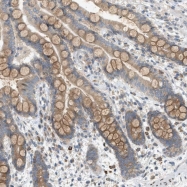 NBP1-84031 - DYRK1A