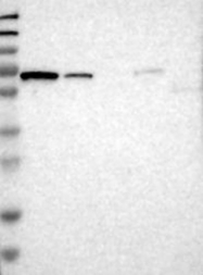 NBP1-84031 - DYRK1A